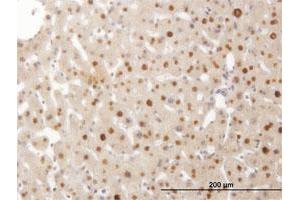 Immunoperoxidase of monoclonal antibody to SMAD6 on formalin-fixed paraffin-embedded human liver.