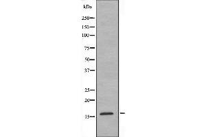 Western blot analysis of extracts from K562 cells, using RPS19 antibody.