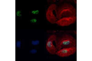 ABIN7093833 and ABIN7097876 staining Hela cells by IF/ICC. (BBX anticorps  (N-Term))