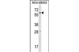 RPUSD2 Antibody (N-term) (ABIN1539609 and ABIN2848866) western blot analysis in MDA-M cell line lysates (35 μg/lane). (RPUSD2 anticorps  (N-Term))