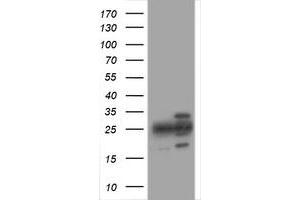 Image no. 1 for anti-Proteasome Subunit alpha 2 (PSMA2) (AA 50-234) antibody (ABIN1491571) (PSMA2 anticorps  (AA 50-234))