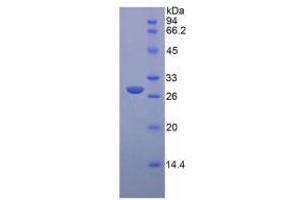SDS-PAGE analysis of Rat Glucuronidase beta Protein. (Glucuronidase beta Protéine)
