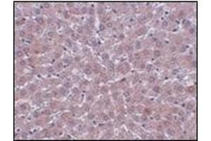 Immunohistochemistry of JMJD1B in rat liver tissue with this product at 2. (KDM3B anticorps  (Center))