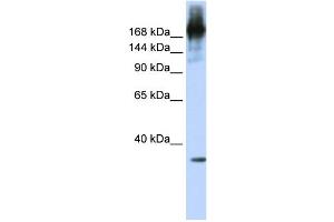 WB Suggested Anti-PRPF8 Antibody Titration:  0. (PRPF8 anticorps  (N-Term))