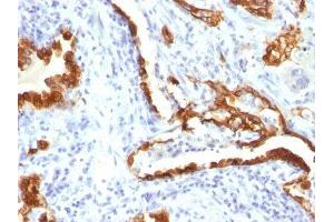 Image no. 3 for anti-Keratin 18 (KRT18) antibody (ABIN6179389) (Cytokeratin 18 anticorps)