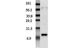 Western blot analysis of adipocyte-conditioned medium from human male and female with different expression levels using anti-Resistin (human), pAb (Biotin) . (Resistin anticorps  (Biotin))