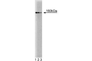 Western blot analysis of ROCK-I on mouse kidney lysate. (ROCK1 anticorps  (AA 906-1012))