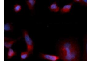 Immunofluorescence (IF) image for anti-Eukaryotic Translation Initiation Factor 1B (EIF1B) (AA 1-113) antibody (PE) (ABIN5567955) (EIF1B anticorps  (AA 1-113) (PE))