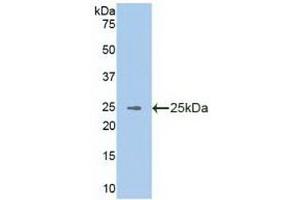 Western blot analysis of recombinant Human VAV3. (VAV3 anticorps  (AA 398-583))