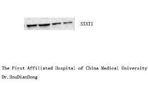 Western Blot (WB) analysis: Please contact us for more details. (STAT1 anticorps  (Internal Region))