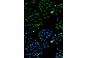 Immunofluorescence analysis of HeLa cells using FKBP3 antibody (ABIN5974155).