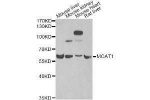 Western blot analysis of extracts of various cell lines, using MGAT1 antibody (ABIN2563858) at 1:1000 dilution. (MGAT1 anticorps)
