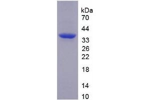 SDS-PAGE analysis of recombinant Human TNIP2 Protein. (TNIP2 Protéine)