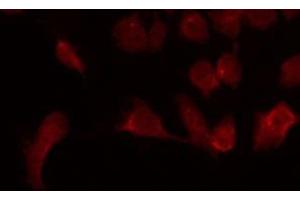 ABIN6275621 staining Hela by IF/ICC. (CD6 anticorps  (Internal Region))