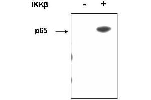 Western blot using  affinity purified anti-p65 (RelA) pS536 antibody shows detection of p65 phosphorylated at S536. (NF-kB p65 anticorps  (pSer276))