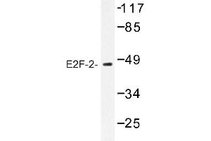 Image no. 1 for anti-E2F Transcription Factor 2 (E2F2) antibody (ABIN272230) (E2F2 anticorps)