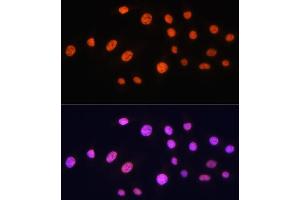 Immunofluorescence analysis of C6 cells using KA Rabbit pAb (ABIN1679964, ABIN5664011, ABIN5664013 and ABIN6219456) at dilution of 1:100 (40x lens).