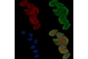 ABIN6262048 and ABIN6268844 staining Hela cells(30 min of UV treatment) by IF/ICC. (QRFPR anticorps  (Internal Region))