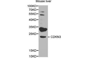 Western blot analysis of extracts of mouse liver, using CDKN3 antibody (ABIN5971092) at 1/1000 dilution. (CDKN3 anticorps)