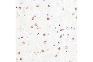Immunohistochemistry of paraffin-embedded rat brain using KLF4 Rabbit mAb (ABIN7268157) at dilution of 1:100 (40x lens).