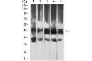 Western blot analysis using ATG4B mouse mAb against Hela (1), RAW264. (ATG4B anticorps  (AA 1-221))