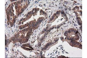 Immunohistochemistry (IHC) image for anti-Destrin (Actin Depolymerizing Factor) (DSTN) antibody (ABIN1497907)
