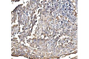 IHC analysis of HMGCS2 using anti-HMGCS2 antibody (ABIN7599435). (HMGCS2 anticorps  (AA 1-487))