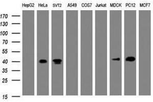 Image no. 1 for anti-NudE Nuclear Distribution E Homolog (A. Nidulans)-Like 1 (NDEL1) antibody (ABIN1499857) (NDEL1 anticorps)