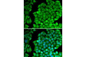 Immunofluorescence analysis of U2OS cells using CCND2 antibody (ABIN6290267). (Cyclin D2 anticorps)