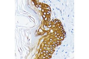 Immunohistochemistry of paraffin-embedded rat skin using Cytokeratin 14 (KRT14) (KRT14) Rabbit mAb (ABIN7268091) at dilution of 1:100 (40x lens). (KRT14 anticorps)