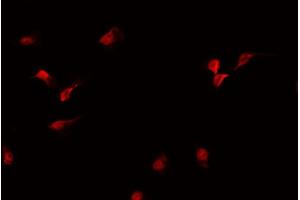 ABIN6269103 staining MCF-7 cells by IF/ICC. (Progesterone Receptor anticorps)