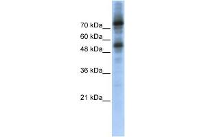 WB Suggested Anti-FOXM1 Antibody Titration:  0. (FOXM1 anticorps  (Middle Region))