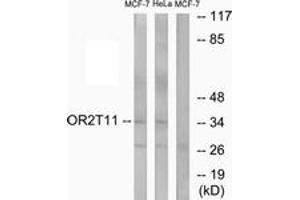 Western Blotting (WB) image for anti-Olfactory Receptor, Family 2, Subfamily T, Member 11 (OR2T11) (AA 51-100) antibody (ABIN2890927) (OR2T11 anticorps  (AA 51-100))