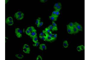 Immunofluorescence staining of HepG2 cells with ABIN7142134 at 1:100, counter-stained with DAPI.
