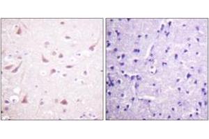 Immunohistochemistry analysis of paraffin-embedded human brain tissue, using DRP-2 (Ab-514) Antibody. (DRP2 anticorps  (AA 480-529))