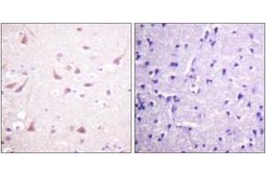 Immunohistochemistry analysis of paraffin-embedded human brain tissue, using DRP-2 (Ab-514) Antibody. (DRP2 anticorps  (AA 480-529))