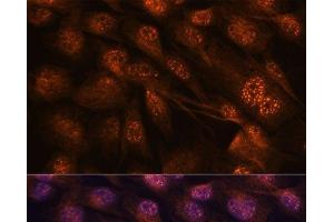 Immunofluorescence analysis of C6 cells using MAP2K7 Polyclonal Antibody at dilution of 1:100. (MAP2K7 anticorps)
