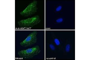 ABIN570702 Immunofluorescence analysis of paraformaldehyde fixed HeLa cells, permeabilized with 0. (AGXT anticorps  (Internal Region))
