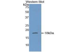 Detection of Recombinant FABP1, Mouse using Polyclonal Antibody to Fatty Acid Binding Protein 1 (FABP1) (FABP1 anticorps  (AA 1-127))