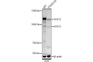 Western blot analysis of extracts from wild type(WT) and ST knockdown (KD) 293T cells, using ST antibody (ABIN1678782, ABIN3017845, ABIN3017846 and ABIN7101526) at 1:1000 dilution.