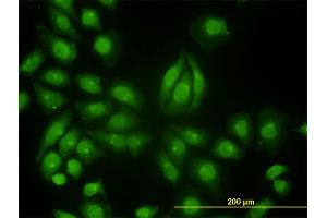 Immunofluorescence of monoclonal antibody to TYK2 on HeLa cell.