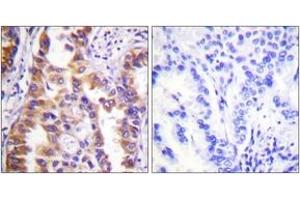 Immunohistochemistry (IHC) image for anti-Tuberous Sclerosis 2 (TSC2) (AA 905-954) antibody (ABIN2888710) (Tuberin anticorps  (AA 905-954))