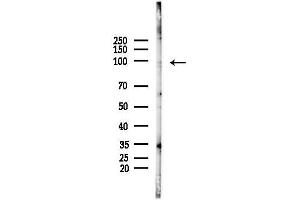 anti-Family with Sequence Similarity 160, Member B2 (FAM160B2) (Internal Region) antibody