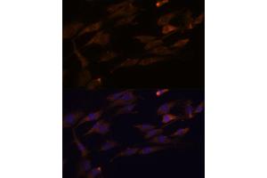 Immunofluorescence analysis of C6 cells using RPL7A antibody (ABIN6128658, ABIN6147151, ABIN6147153 and ABIN6218286) at dilution of 1:100.