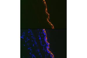 Immunofluorescence analysis of Mouse tail and ear using Cytokeratin 10 Rabbit mAb (ABIN1679404, ABIN3019133, ABIN3019134 and ABIN7101721) at dilution of 1:100 (40x lens). (Keratin 10 anticorps)