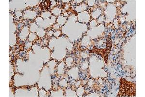 ABIN6267395 at 1/200 staining Mouse lung tissue sections by IHC-P. (GATA1 anticorps  (pSer142))