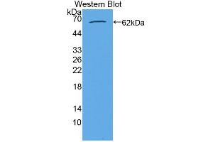 Western blot analysis of the recombinant protein. (Acylglycerol Kinase anticorps  (AA 15-300))