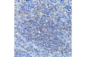 Immunohistochemistry of paraffin-embedded mouse spleen using CSF3 antibody (ABIN6127710, ABIN6139100, ABIN6139101 and ABIN6221772) at dilution of 1:100 (40x lens).