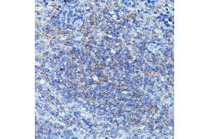 Immunohistochemistry of paraffin-embedded mouse spleen using CSF3 antibody (ABIN6127710, ABIN6139100, ABIN6139101 and ABIN6221772) at dilution of 1:100 (40x lens). (G-CSF anticorps  (AA 30-207))