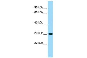 WB Suggested Anti-ACER2 Antibody Titration: 1. (ACER2 anticorps  (Middle Region))